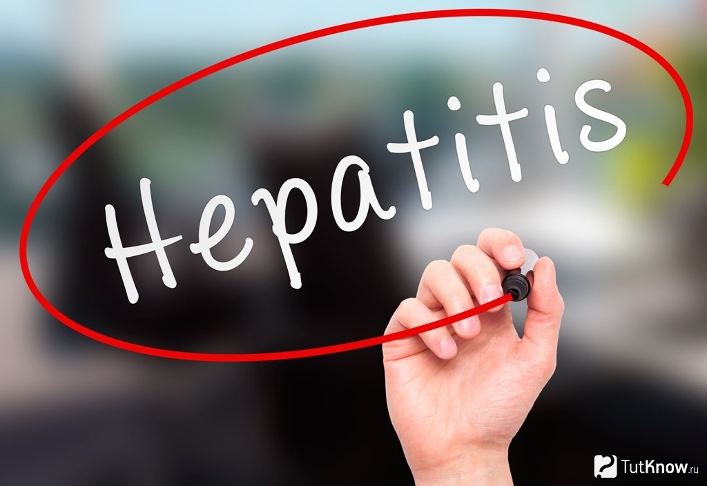 Гепатит туралы не білген жөн?