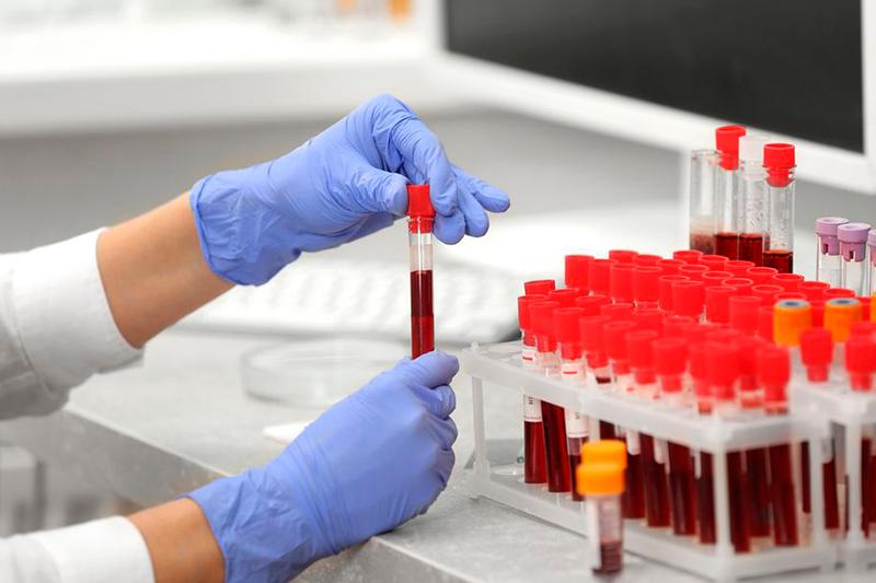 Қазақстанда коронавирусқа қарсы вакцина әзірленуде