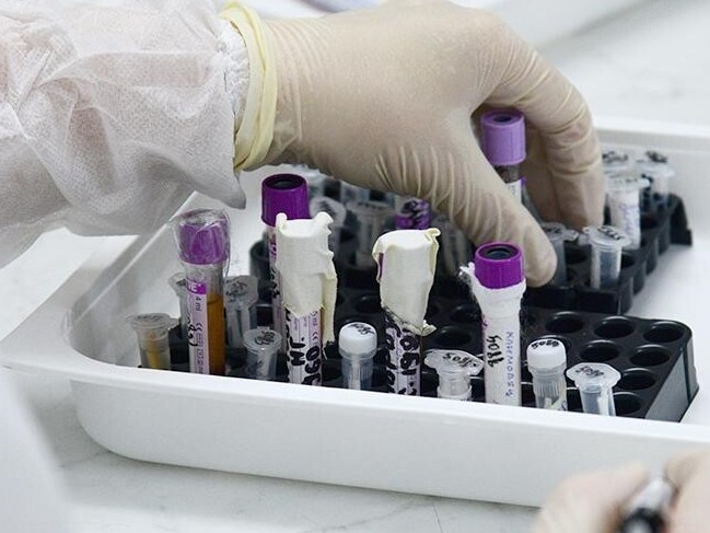 СҚО: Коронавирус жұқтырған қыздың жағдайы бірқалыпты