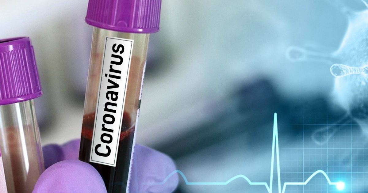 Нұр-Сұлтанда соңғы тәулікте 14 адамның қайдан індет жұқтырғаны анықталды