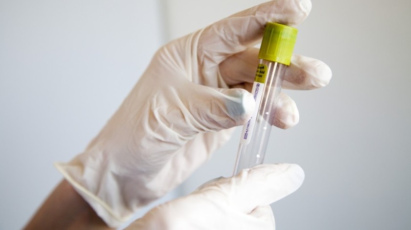 Қызылорда: Науқастардың жағдайы қалыпты