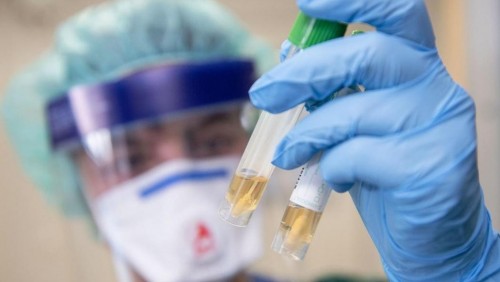 Қызылорда облысында COVID-19 инфекциясын жұқтырған 11 жағдай туралы ақпарат