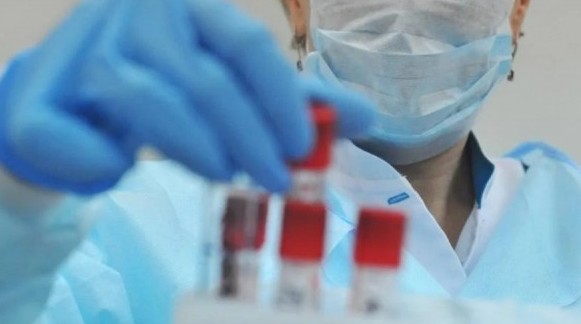 Елде коронавирустан жазылғандар саны 99-ға жетті