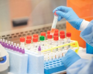 Коронавирус инфекциясын жұқтырған тағы 8 адам тіркелді