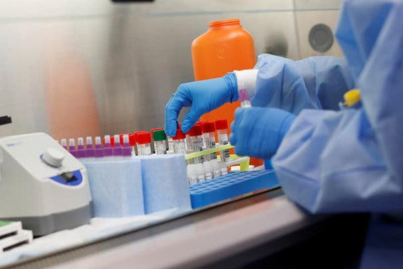 Елімізде тағы 24 адам коронавирус инфекциясынан жазылып шықты