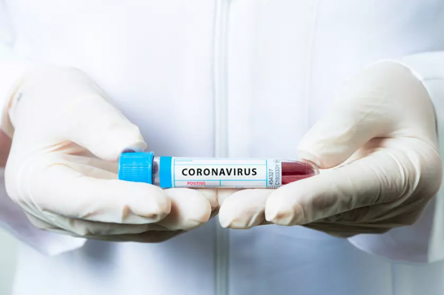 Жітіқарада 4 адамнан COVID-19 анықталды