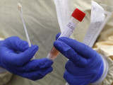 Ақмола облысында коронавирус жұқтырған тағы 10 адам анықталды
