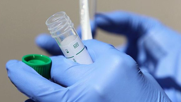 Бір тәулікте коронавирус пен пневмониядан 13 адам қайтыс болды