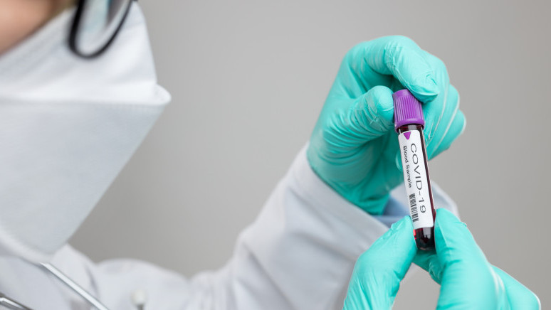 Атырау облысында үш тәулікте 344 адам коронавирусқа шалдықты