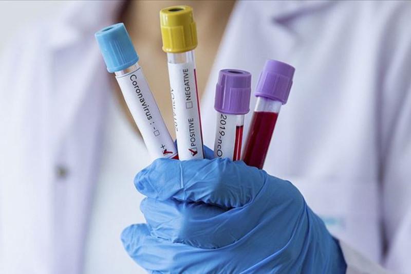 Коронавирус: Алматыда бір тәулікте 293 науқас анықталды