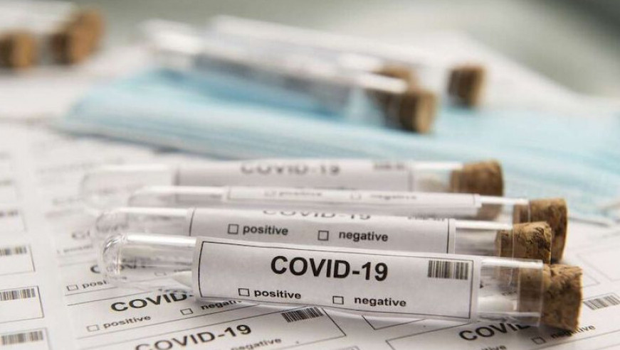 Баладан да ПТР-тест сұралады