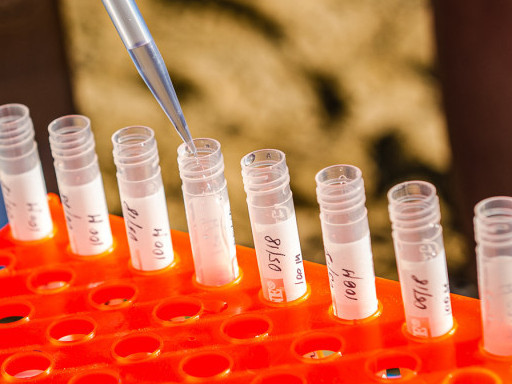 Ресейлік ғалымдар коронавирусты жылдам анықтайтын құрылғы ойлап тапты