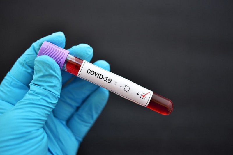 Қазақстанда бір тәулікте 62 адам коронавирус жұқтырған