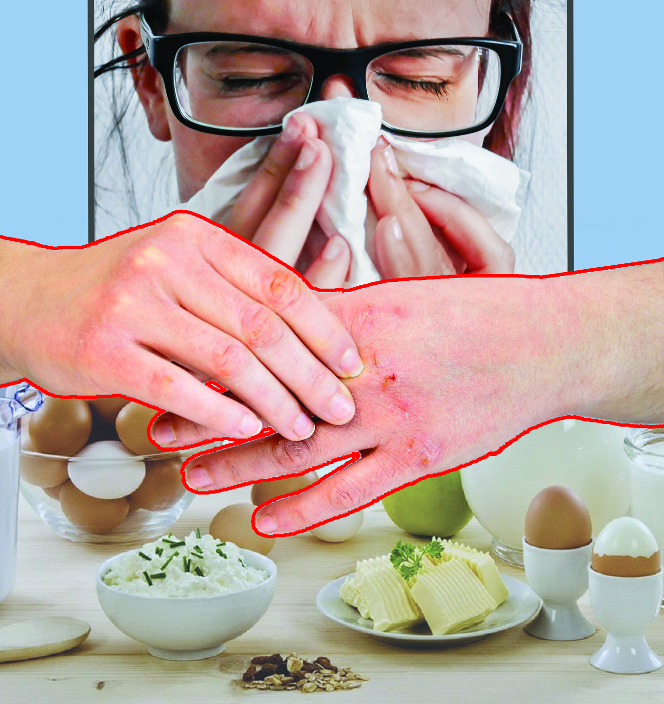 Аллергиялық ауруларды асқындырып алмаңыз!