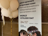 Зиянды емес тері ауруы: Алматыда Витилиго күні атап өтілді