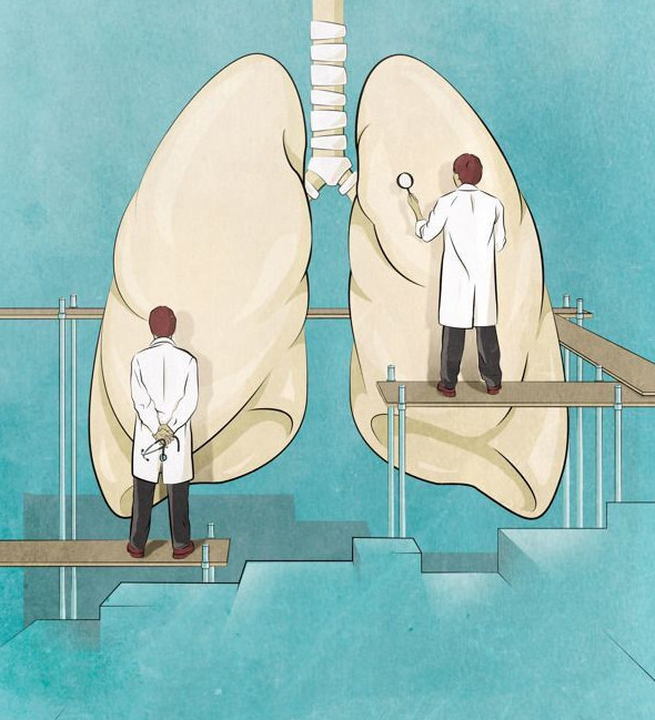 Қазақстанда туберкулезден болатын өлім-жітім 10%-ға азайған