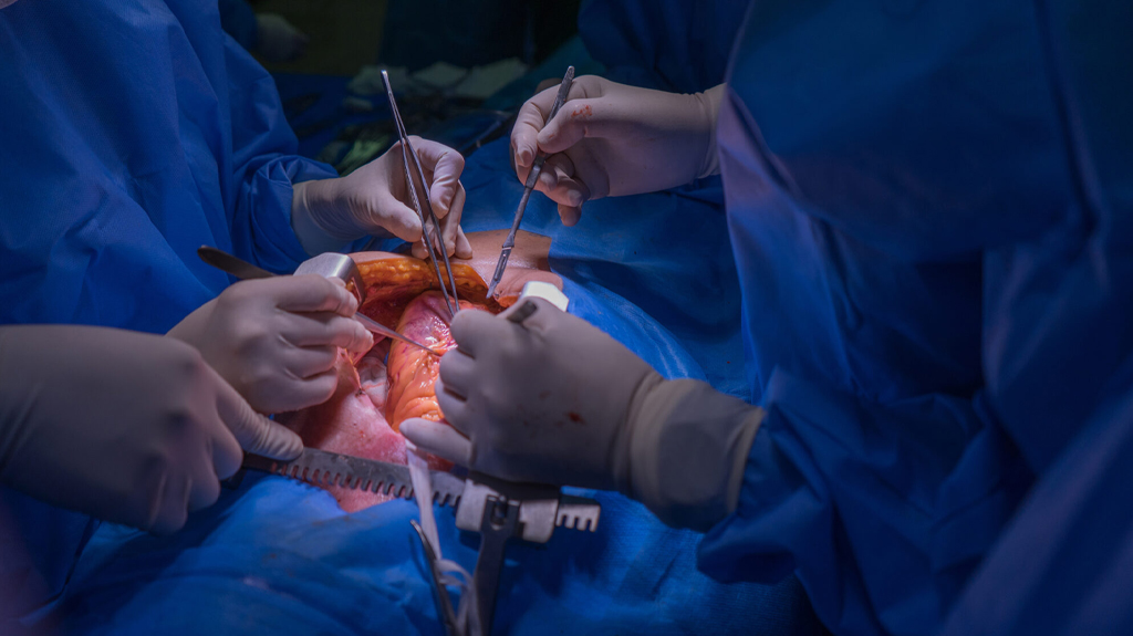 Елімізде алғаш рет 15 жастағы балаға жүрек трансплантациясы жасалды